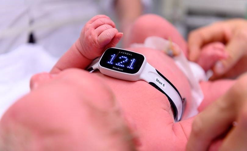 Nyfødt baby med Neobeat-bøyle rundt magen. Neobeat er en hjertefrekvensmåler for nyfødte