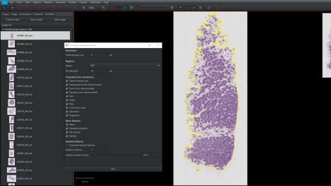 Whole Slide Imaging, Digitalization and Automation of Histopathological Lesion Evaluation in Marine Organisms