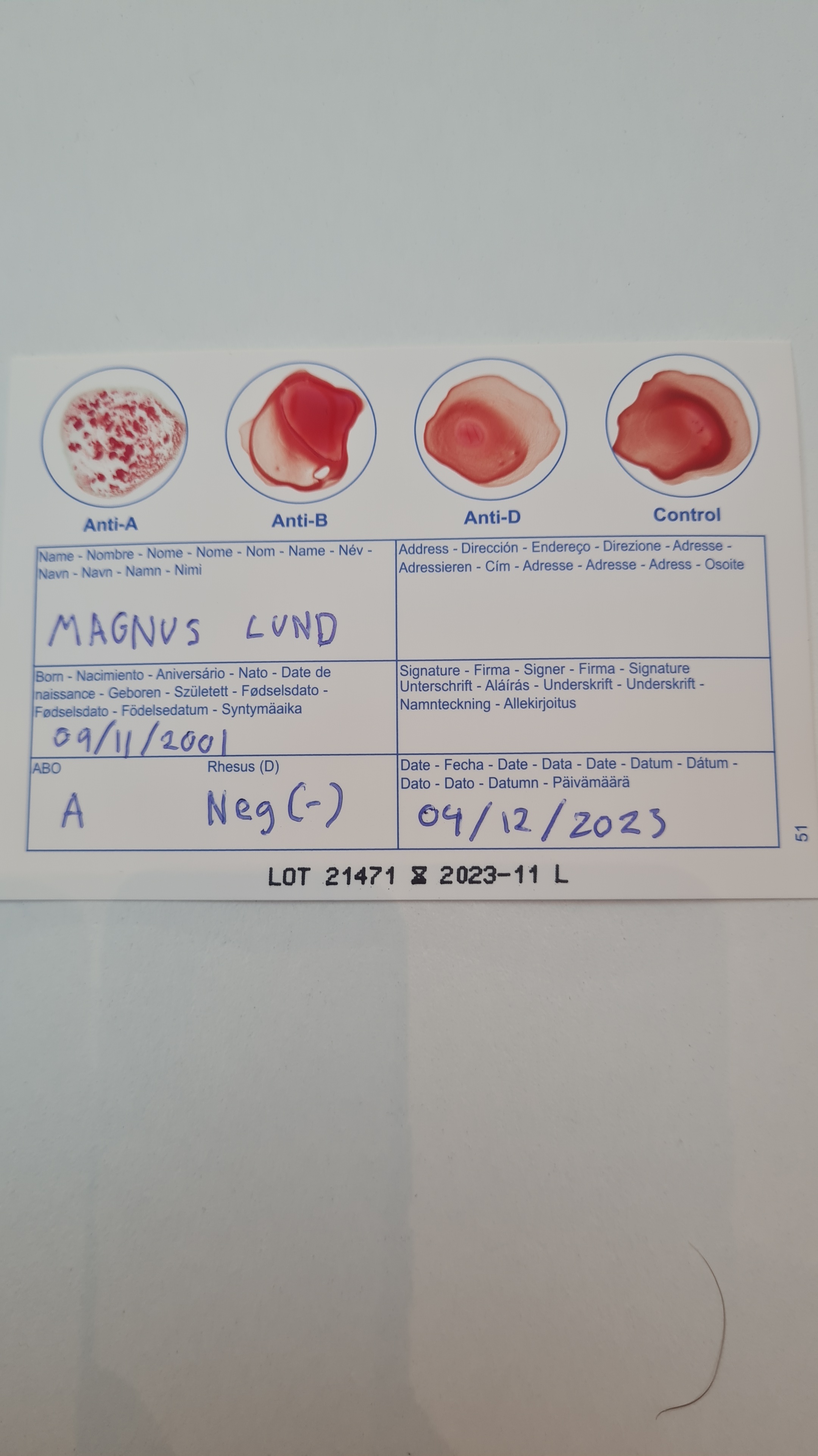 Skjema som viser testing av blodtype