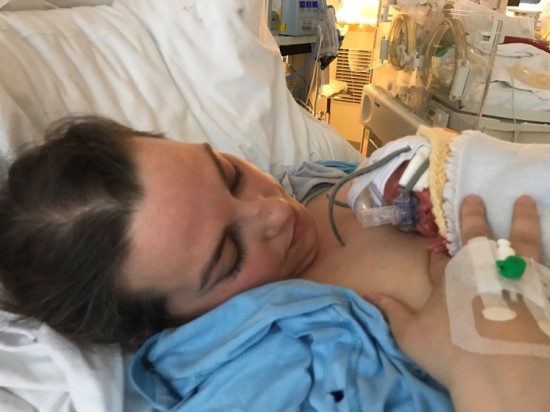 Prematur baby med pustestøtte ligger på mors bryst